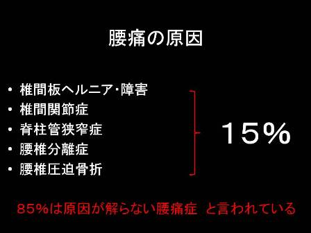 ８５％は原因が分からない腰痛症