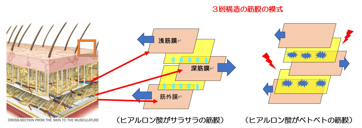 ３層構造の筋膜の模式