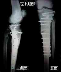 �����g�Q���ʐ^